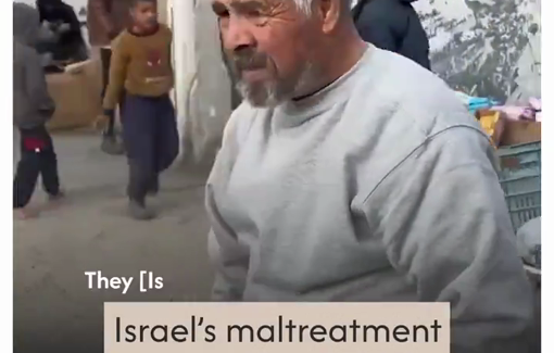 Thumbnail preview image for the video titled: "I haven't taken a shower for 16 days... They tortured me and hit me hard in my chest"