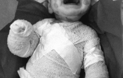 Thumbnail preview image for the video titled: Baby Jalal Al-Qotsh dies in Gaza amid continuous Israeli restriction of medical aid and evacuations