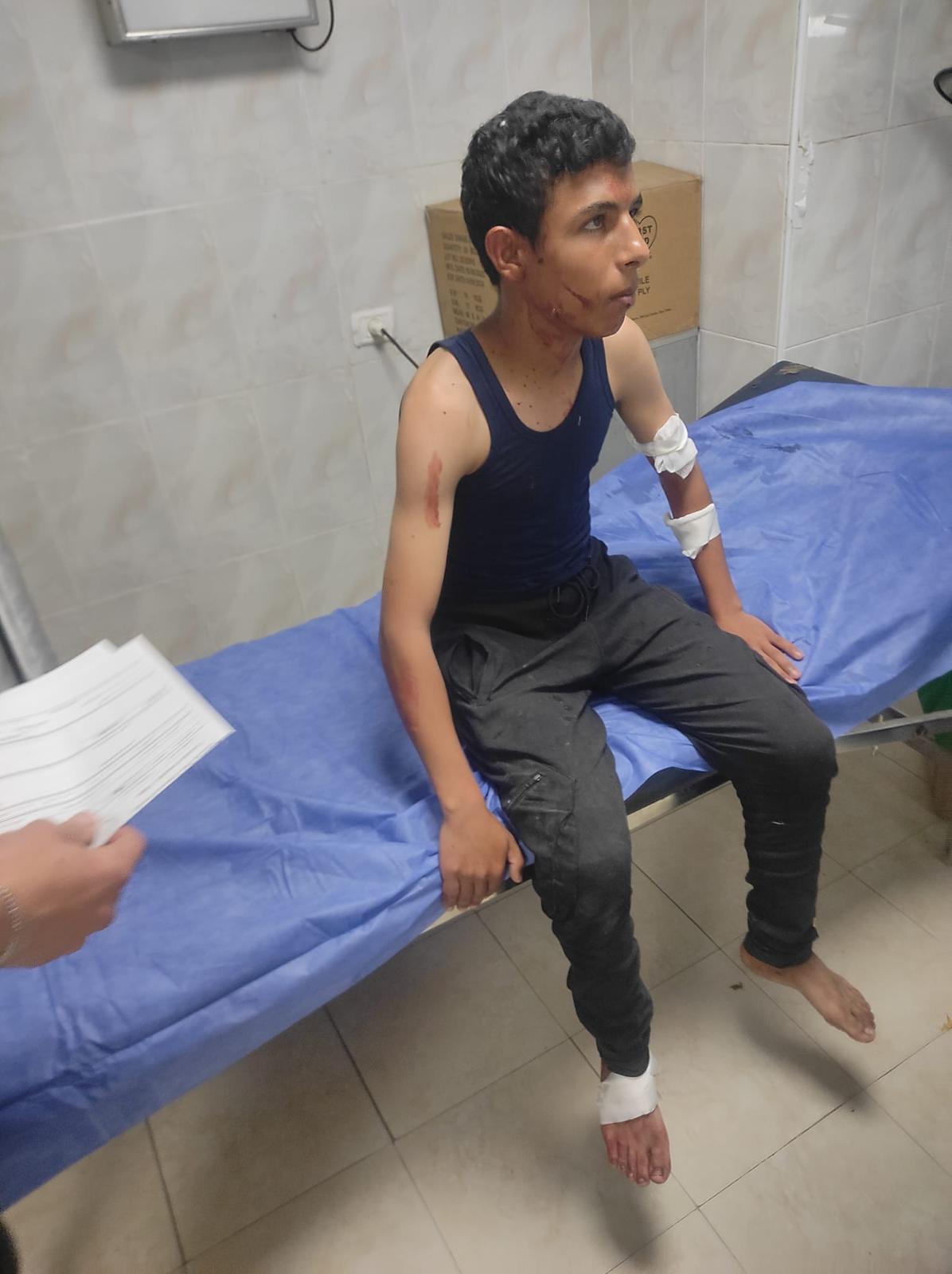 Thumbnail preview image for the video titled: Minor injured in Israeli airstrike on Tal al-Hawa, Gaza City