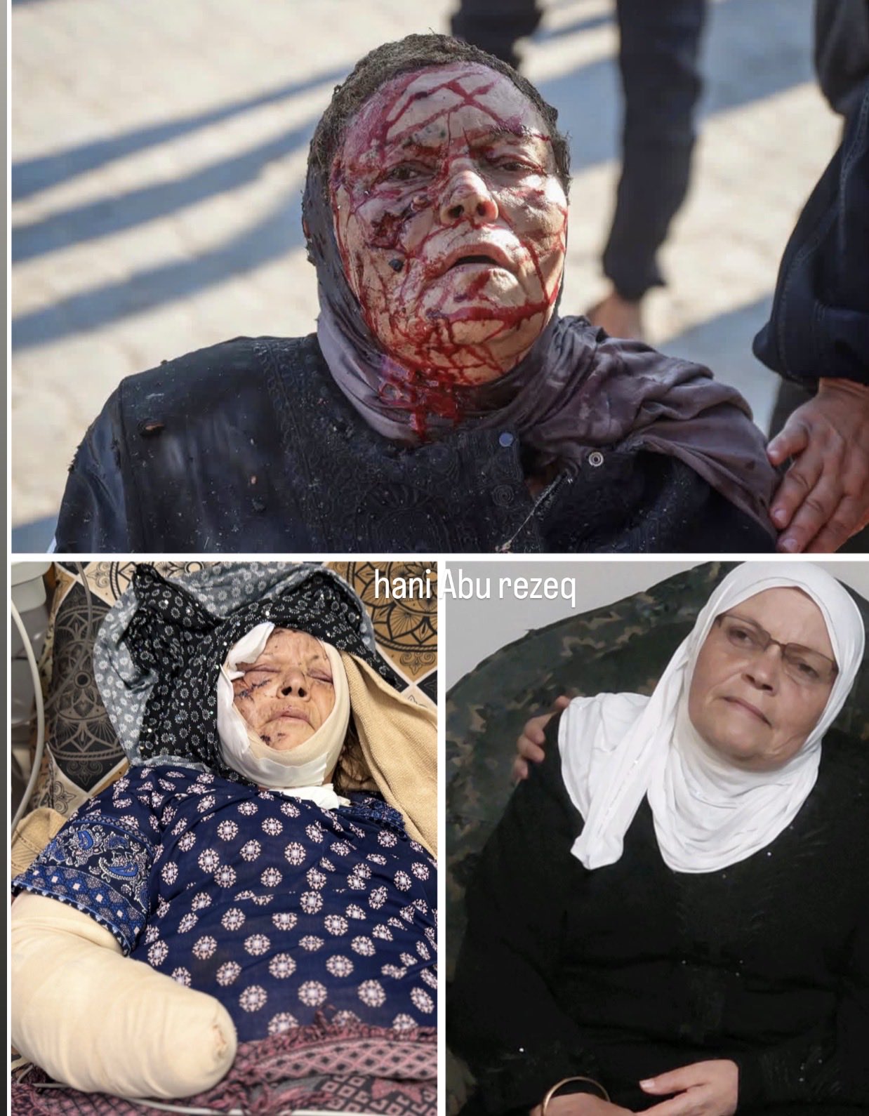 Thumbnail preview image for the video titled: Elderly mother Laila Mortaja lost her right hand and son in Israel's bombing of Gaza Port cafe