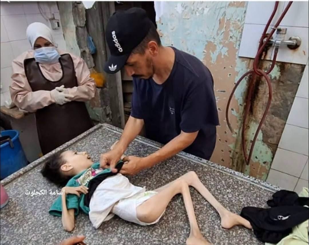 Thumbnail preview image for the video titled: Child Maha Bashir starved to death by Israel's policy of restricting essential aid to Gaza