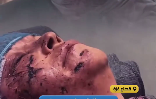 Thumbnail preview image for the video titled: Elderly mother Laila Mortaja seriously injured after losing her hand and son in Israel's cafe bombing