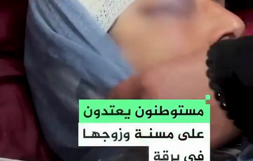 Thumbnail preview image for the video titled: Settlers brutally beat elderly woman Fatema Ma’tan and her husband Wajih Hamdan in Burqa