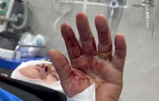 Thumbnail preview image for the video titled: 9 Palestinians injured in a pogrom by Israeli settler targeting farmers while harvesting olives in Ramin plain