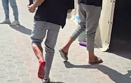 Thumbnail preview image for the video titled: Casualties taken to hospital following Israeli strike on group of people in west Gaza City