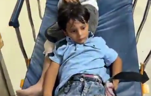 Thumbnail preview image for the video titled: Siblings Wasim and Amir Shorrab among 3 children injured by Israeli gunfire in Khan Younis