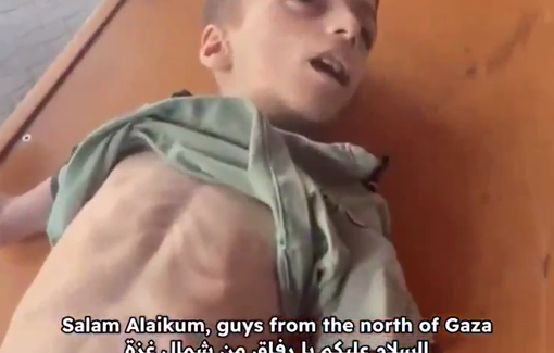 Thumbnail preview image for the video titled: Azzam is a 6-year-old boy who died of starvation today in Al-Ahli Hospital in northern Gaza