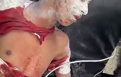 Thumbnail preview image for the video titled: Palestinian youth was taken to the Baptist Hospital after IDF bombed his house